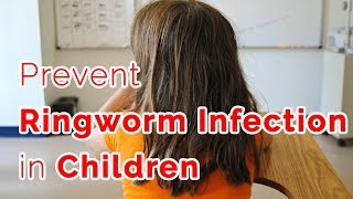 What causes ringworms in children? - Dr. Rajdeep Mysore