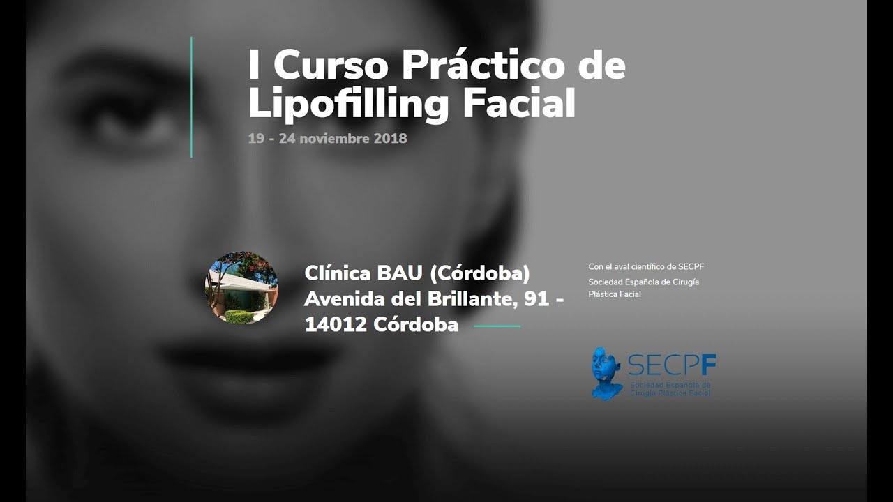 Alberto Candau Álvarez-57