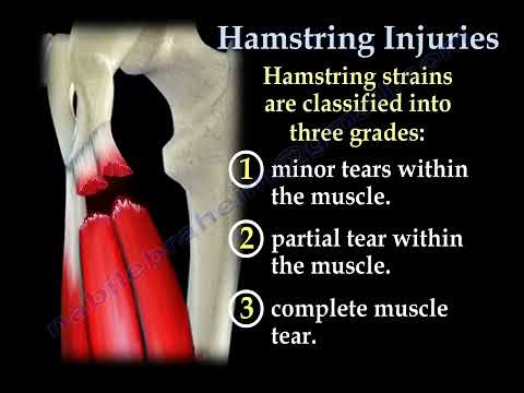 Hamstring Injuries: Symptoms, Diagnosis, and Treatment Strategies 