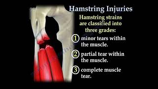 Hamstring Injuries, symptoms, diagnosis and treatment