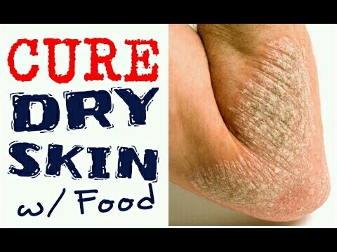 10 BEST CURES for DRY SKIN | Cheap Tip #208 Video