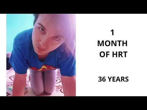 MTF Transition Timeline - 16 months on HRT