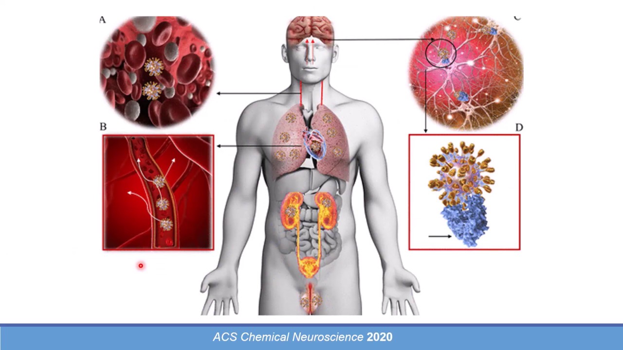 Pathophysiological Approach to the Management of Severe COVID-19 Cases!