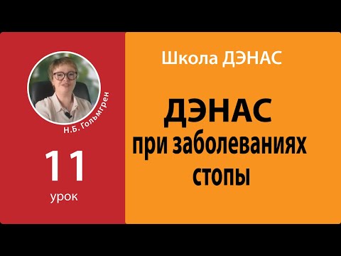 Школа ДЭНАС Урок 11 ДЭНАС при заболеваниях стопы