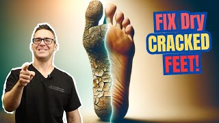 STOP Dry Itchy Skin & Dry Cracked Feet! [Best Creams & Home Remedies]