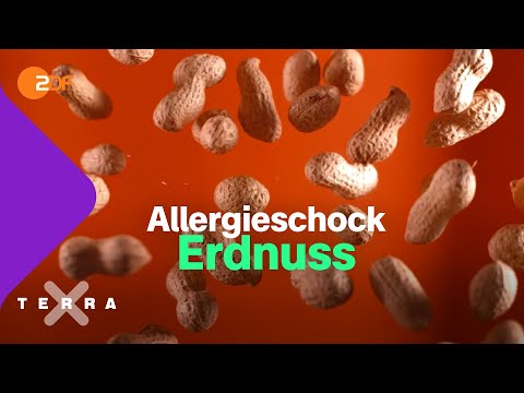 Todesgefahr durch Erdnüsse? Was eine Allergie und allergischer Schock ist  | Terra X plus
