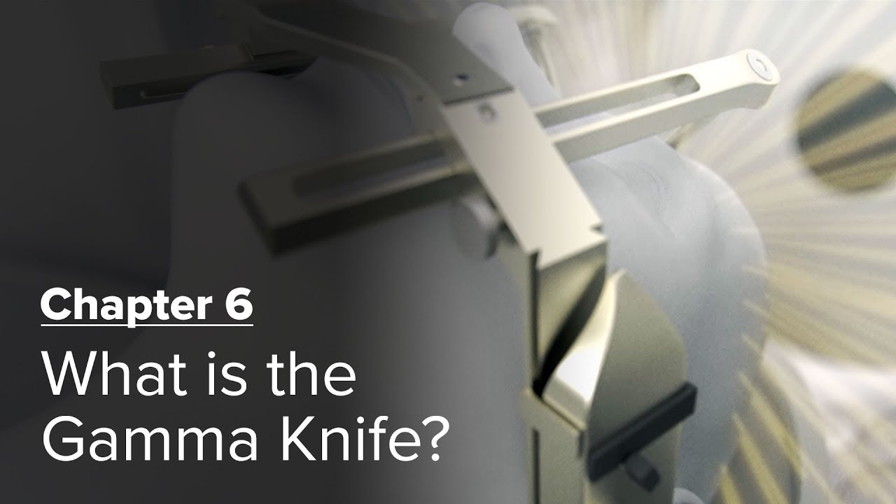 What is the Gamma Knife? Chapter 6 — Brain Metastases: A Documentary