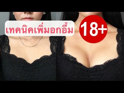 การปลูกรากฟันเทียมบนหน้าอกกว้าง หน้าอกพลาสติกคิดเห็น Bryansk