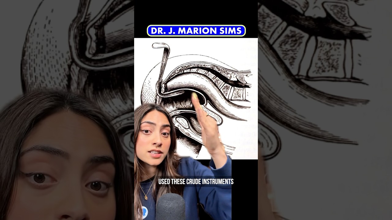 The Dark Medical Origins of the Speculum