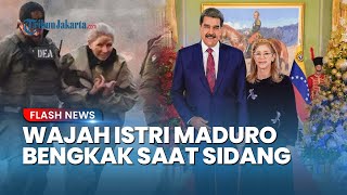 Kondisi Wajah Istri Presiden Maduro Bengkak Saat Hadir di Persidangan, Tulang Rusuk Flores Patah