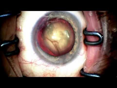 Lacido da pigmentary nota risposte La ragione di apparizione di pigmentary nota a età avanzata