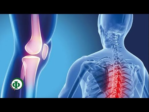 Упражнения от боли в голове от шеи Остеохондроз лечение при гастрите