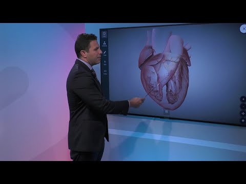 Leaky Heart Valve: Causes & Symptoms