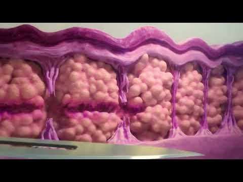 How It Works - RESONIC Cellulite Treatment