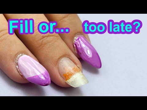 When it’s too LATE for Nails Fill… Sealed Lifting, Undercured Gel & more