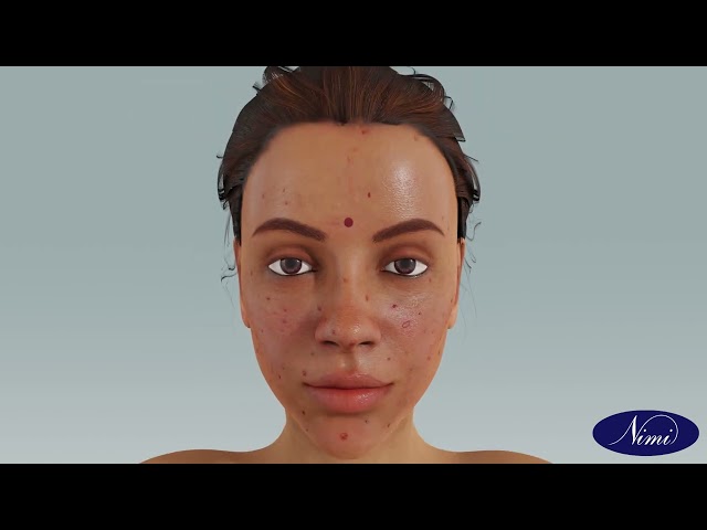 Client Drape & skin Analysis