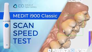 Scanning Speed Test of the Medit i900 Classic | iDD