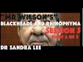 "Mr Wilson's" blackhead extractions, Session 5 ...