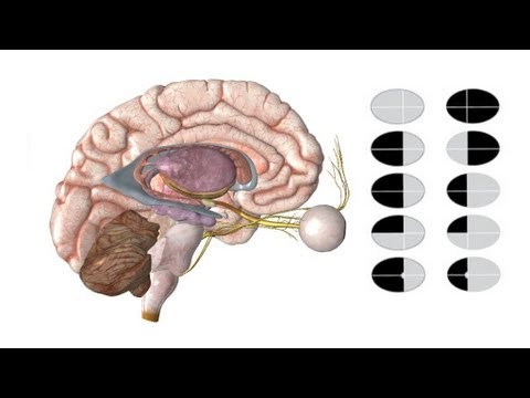 Examen du champ visuel en 5 minutes