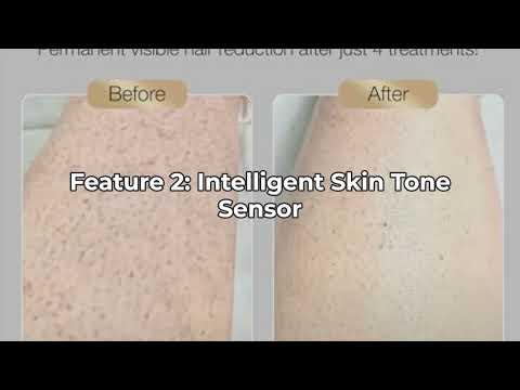 Is Braun IPL worth it? Braun IPL Silk·Expert Pro 5 PL5347 Latest Generation IPL for Women and Men