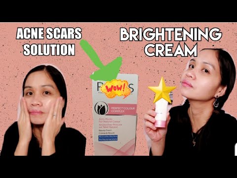 POND'S PERFECT COLOUR COMPLEX FOR ALMOST A WEEK/ ACNE AND PIMPLES SCARS SOLUTION