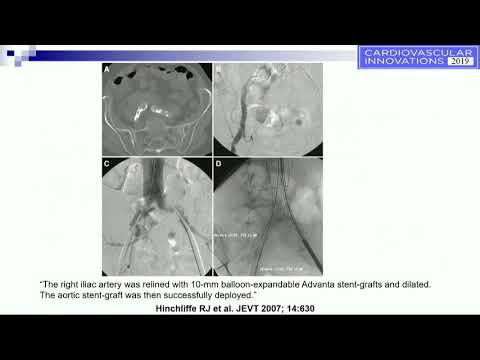 CVI 2019_Friday 7/19_ Aortoiliac Disease _Nicolas Shammas, MD, MS, EJD