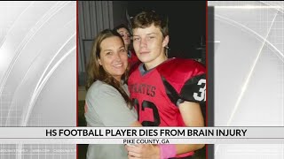 Football player dies from brain injury