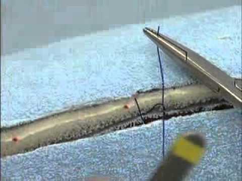 Interrupted Suture Patterns: Burying the Knot