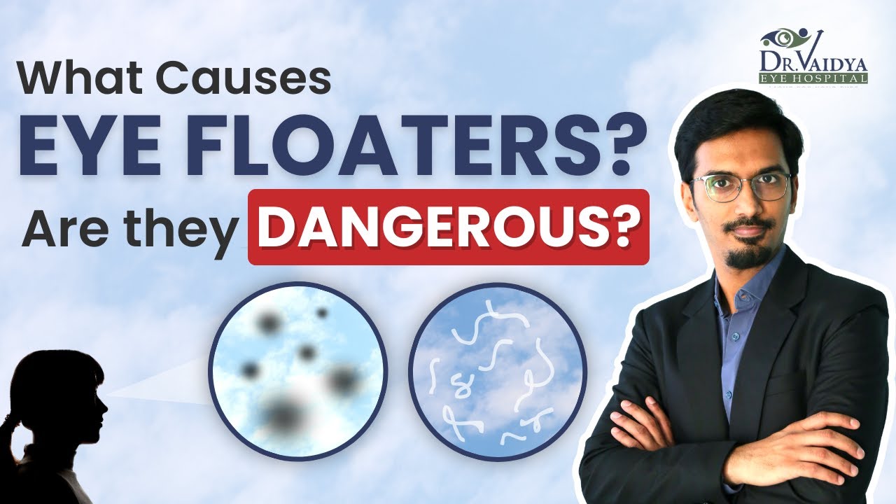 What Causes Eye Floaters? Are they Dangerous?