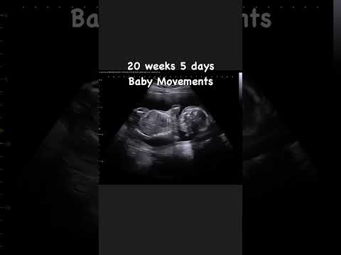 20 weeks 5 days Baby Movements 🥰 #jerbearimaging #athome #ultrasound #babymovement #babylife #sono