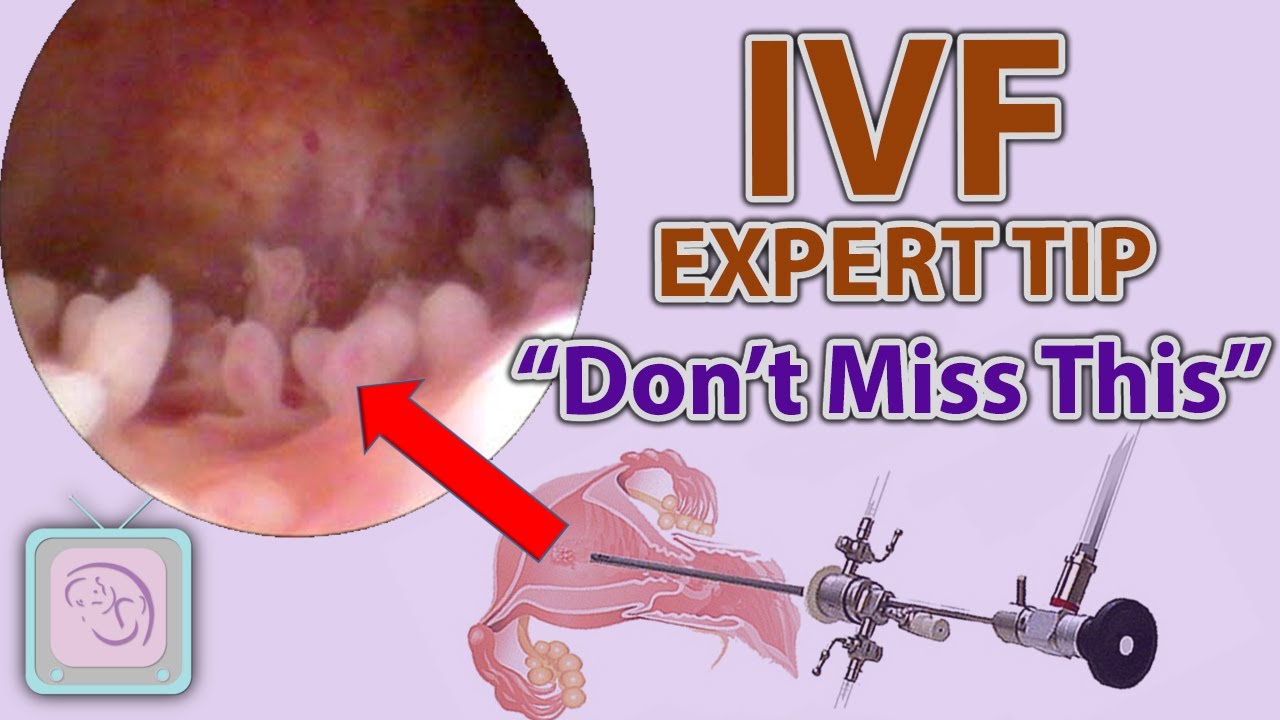 How do I know if I have appendicitis pain? Tipseri