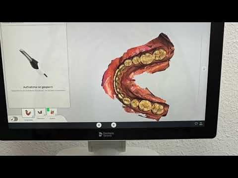 Ablauf einer Scankrone