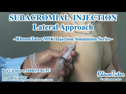 SUBACROMIAL SHOULDER INJECTION - LATERAL APPROACH: Step-By-Step Instructions