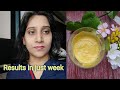 7 Days Challenge Removed Dark Spots Pigmentation Spotless Clear Skin दाग धब्बे ह�