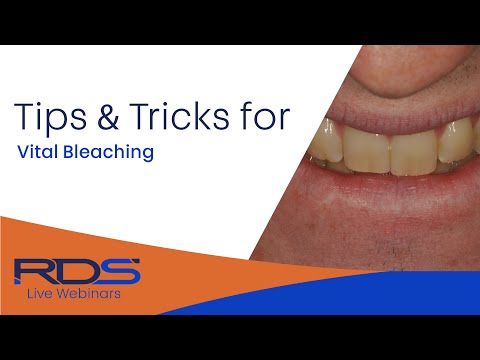 Tips And Tricks For Vital Bleaching