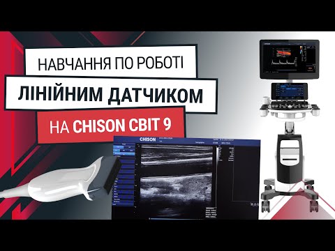 Как работать линейным датчиком на Chison Cbit 9 - Статьи RH