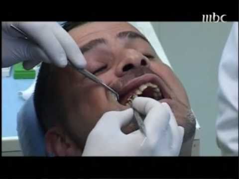 smile makeover  1