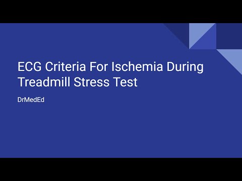 ECG Criteria For Ischemia During Treadmill Stress Test