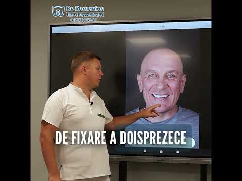 Reabilitarea completă cu 12 implanturi dentare. Caz Clinic D. Alexandr