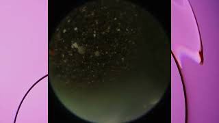 Underwater Euphotic Zone #phytoplankton, #euphoticzone, #xanthophyllis,