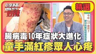 腸病毒10年症狀大進化！女童手臂爬滿紅疹.指甲脫落令人心疼！【#醫師好辣】20240609 EP1638 精選
