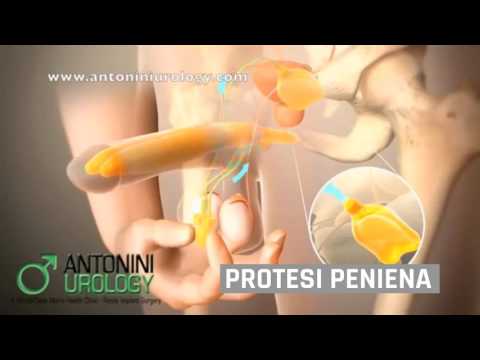 Soluzioni per migliorare la potenza consigliata Recensioni di forza Imperatore potenza