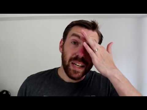 My Thyroid Cancer Story - Sh*t's Gone Sideways - 06/08/2018