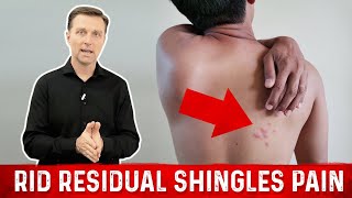 The Fastest Technique to Get Rid of Shingles Pain