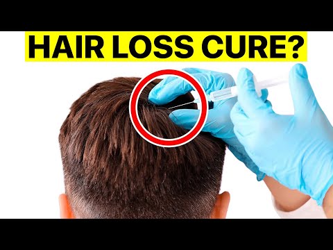 The Science Behind PRP Treatments for Hair Regrowth (Platelet-Rich Plasma)