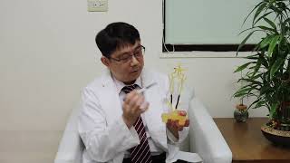 搶救急性缺血性腦中風 緊急穿刺頸動脈救命│陳文賢醫師