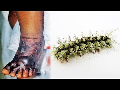 TOP 10 Most Poisonous Bugs In The World