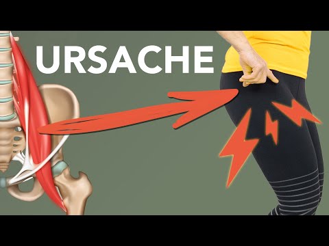 Hüftschmerzen: Ursache & Hilfe bei Hüftschmerzen (Schleimbeutelentzündung)