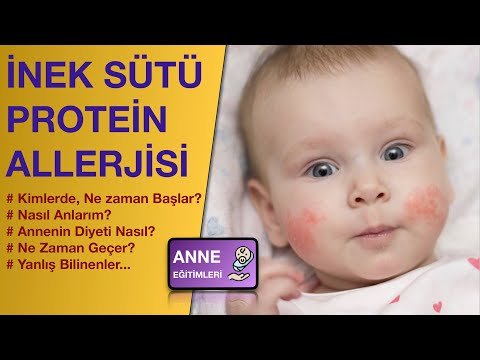 , title : 'Bebeklerde İnek Sütü Allerjisi ( Kimde , Ne zaman , Nasıl Anlarım, Diyet, Önlem...)'