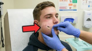 Er drückte ein eingewachsenes Haar — Sekunden später waren Ärzte schockiert, was passierte. danach